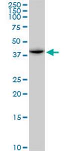 ACADM Polyclonal Antibody, MaxPab™
