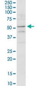 ACADM Polyclonal Antibody, MaxPab™