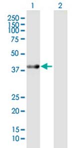 ACAT2 Polyclonal Antibody, MaxPab™