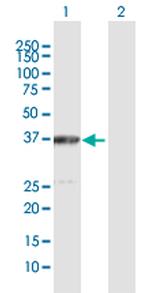 ACAT2 Polyclonal Antibody, MaxPab™