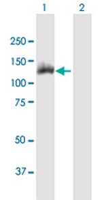 ACLY Antibody in Western Blot (WB)
