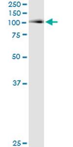 ACO1 Monoclonal Antibody (2C1)