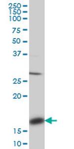 ACP1 Antibody in Western Blot (WB)