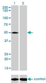 ACP2 Antibody in Western Blot (WB)