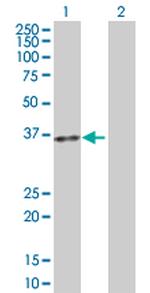ACP5 Polyclonal Antibody, MaxPab™