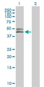 ACPP Polyclonal Antibody, MaxPab™