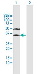 ACRV1 Polyclonal Antibody, MaxPab™