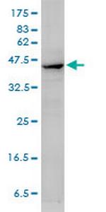 ACTA2 Monoclonal Antibody (4A8-2H3)