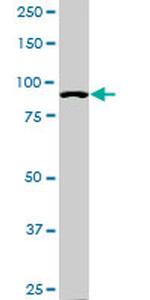 ACTN4 Antibody in Western Blot (WB)