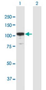 ACTN2 Antibody in Western Blot (WB)