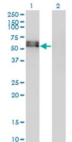 ACVR1 Monoclonal Antibody (2D5)