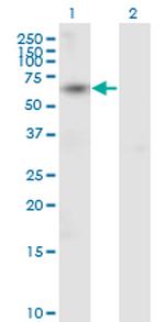 ACVR1B Monoclonal Antibody (2E12)