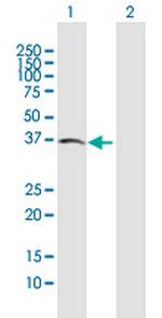 ACVR2B Polyclonal Antibody, MaxPab™
