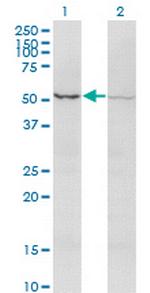 ACVR2B Monoclonal Antibody (1C11)
