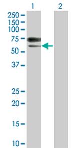 ACVRL1 Monoclonal Antibody (7H2)