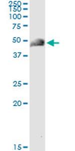 ACY1 Antibody in Immunoprecipitation (IP)