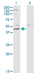 ACY1 Monoclonal Antibody (1A11-F6)