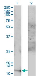 ACYP1 Monoclonal Antibody (S3)