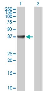 ADA Polyclonal Antibody, MaxPab™