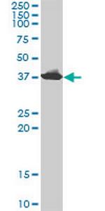 ADA Monoclonal Antibody (4G4-1C6)