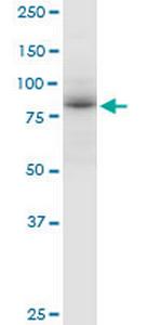 ADARB1 Polyclonal Antibody, MaxPab™