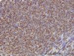 ADD1 Monoclonal Antibody (2C9)