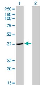ADH4 Antibody in Western Blot (WB)