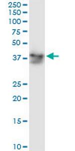 ADH5 Monoclonal Antibody (12F7)