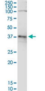 ADH5 Monoclonal Antibody (2D11)