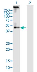 ADRB2 Polyclonal Antibody, MaxPab™
