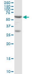 ADSL Polyclonal Antibody, MaxPab™