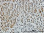 AEBP1 Monoclonal Antibody (1D2)