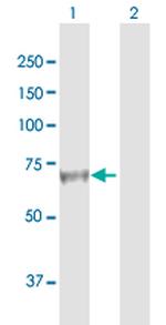 AFP Antibody in Western Blot (WB)