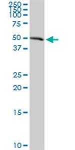AGER Antibody in Western Blot (WB)