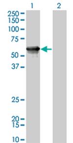 AGER Monoclonal Antibody (1C1)