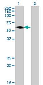 AGER Monoclonal Antibody (1D1)