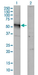 AGT Monoclonal Antibody (1A10)