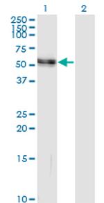 AGT Antibody in Western Blot (WB)