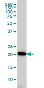 AK1 Monoclonal Antibody (M2)