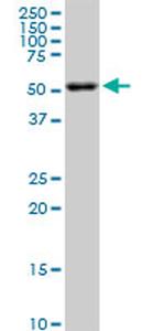 AKT2 Antibody in Western Blot (WB)