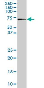 ALAS1 Monoclonal Antibody (2D5)