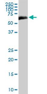 ALB Antibody in Western Blot (WB)