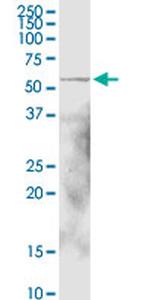 ALDH1A1 Antibody in Western Blot (WB)