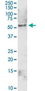 ALDH1A1 Antibody in Western Blot (WB)