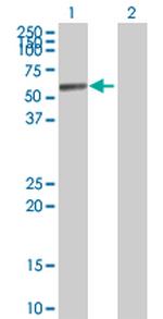 ALDH1A1 Polyclonal Antibody, MaxPab™