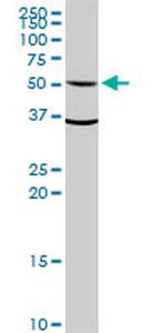 ALDH1A1 Antibody in Western Blot (WB)