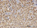 ALDH1A1 Antibody in Immunohistochemistry (Paraffin) (IHC (P))