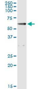 ALDH1A1 Antibody in Immunoprecipitation (IP)