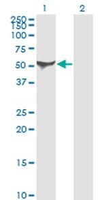 ALDH1A1 Antibody in Western Blot (WB)