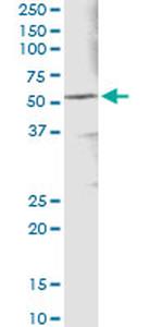 ALDH3A1 Monoclonal Antibody (2G4)